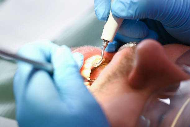 Best Emergency Broken Tooth Repair in San Diego, TX