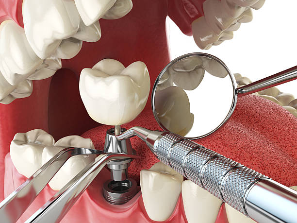 Best Emergency Dental Surgery in San Diego, TX